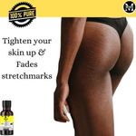 product_image_name-Mekis-Lemon Oil – Prevent Pimples,Acne, Sagging & Premature Aging-4