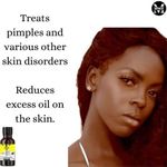 product_image_name-Mekis-Lemon Oil – Prevent Pimples,Acne, Sagging & Premature Aging-5