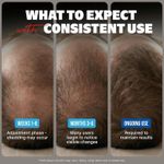 product_image_name-Kirkland Minoxidil-5% For Men Hair Regrowth Treatment Topical Solution - 6 Month Supply-3