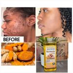 product_image_name-VEET GOLD-Turmeric Oil Super Whitening & Brightening Body Oil, 300ml-3