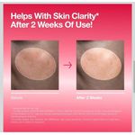 product_image_name-Generic-Anua Niacinamide 10+ TXA 4 Original Serum -3