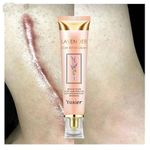 product_image_name-Quality- Yoxier Lavender Scar Repair Cream – Remove Scars, Acne Marks, Anti-Inflammatory – 20g-1