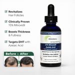 Kirkland Minoxidil 15% Minoxidil + Azelaic Acid Hair Regrowth Treatment – Fast Hair & Beard Growth Solution, Anti Hair Loss for Men