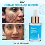 product_image_name-SAAM-Miracle Acne Serum Perfect Anti-acne Solution-3