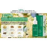 Breylee Tea Tree Oil Acne Serum 2.0 Treatment Acne Prone Sensitive Skin Care Face Serum to Cystic Acne Scars Redness Relief Pimples Dark Spots Remove Niacinamide Facial Moisturizer 30ml/1.01fl oz 30ml