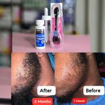 product_image_name-KIRKLAND Signature-Minoxidil 5% Topical Solution and a derma roller-1