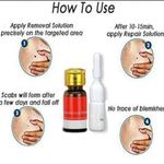 product_image_name-Generic-Dr. Luei Speckle Killer & Wart / Skin Tag Remover - 6ml-3