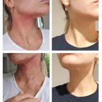 product_image_name-Generic-Supre Collagen Glutathion + Vitamin C 1 Piece -8