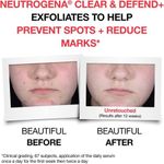 product_image_name-Neutrogena-Clear And Defend+ Serum 30ml-3