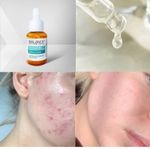 product_image_name-Balance Active Formula-Niacinamide Blemish Recovery Serum -4
