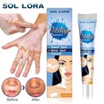 product_image_name-Generic-Vitiligo Ointment White Spot Cream Sweaty White Spotted Skin Ointment-1