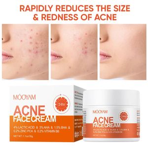 MOOYAM Acne Treatment for Face, Salicylic Acid Acne Cream Back Acne Treatment Cream - 30g