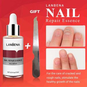 Lanbena Foot Nail Fungus Treatment Essence Nail Care Repair Gel Onychomycosis Treatment
