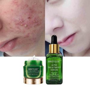 Breylee Pimple & Acne Treatment Cream and Serum set,