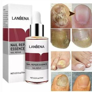 Lanbena Nail Repair Essence For Nail Treatment Anti Fungal Nail Solution