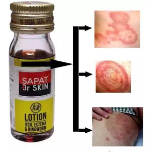 Topicals Sapat Lotion for Eczema, Ringworm, Itch - 100% Herbal 