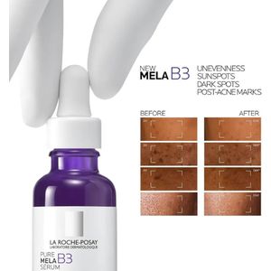 LA ROCHE-POSAY Mela B3 Serum, Dark Spot Corrector With Anti-Aging Melasyl + 10% Niacinamide, Discoloration Correcting Serum for Sun Spots, Age Spots & Post-Acne Marks