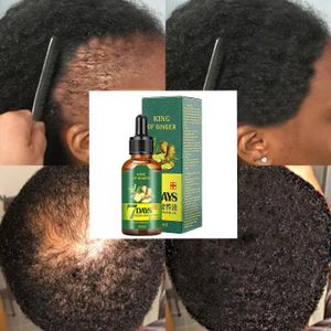 7 Day 7 Days Hair Growth Oil  - 30ml