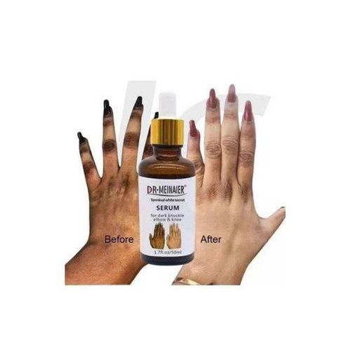 product_image_name-Dr meinaier-Strong knuckle Remover Serum Terminal White Secret Serum - 50ml-2