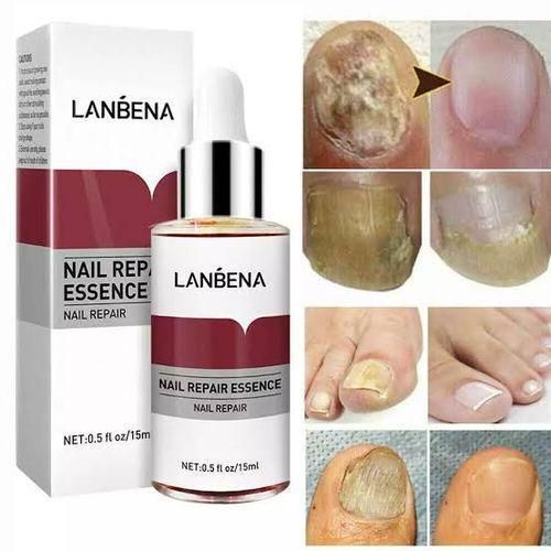 product_image_name-Lanbena-Nail Repair Essence For Nail Treatment Anti Fungal Nail Solution-1