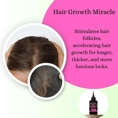 product_image_name-Mekis-Chebe,Amla,Rosemary & Peppermint Oils  Hair Oil - 4 in 1,Hair Growth Miracle, Combat Hair Loss, Dandruff Defiance ,Intense Hydration, Split End Savior-6