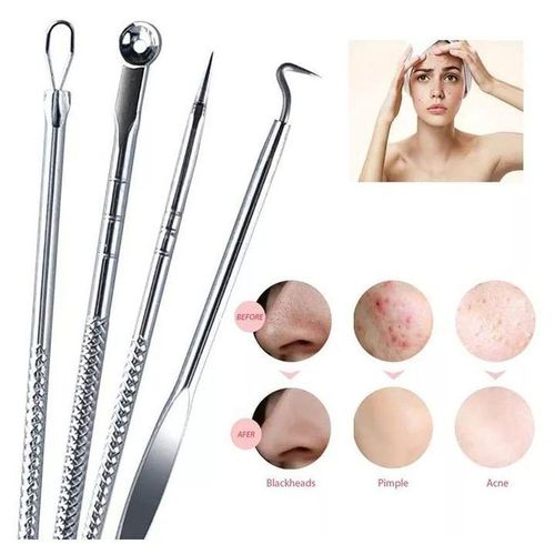 product_image_name-Generic-4pcs Stainless Steel Facial Acne  Remover Tool Set-1