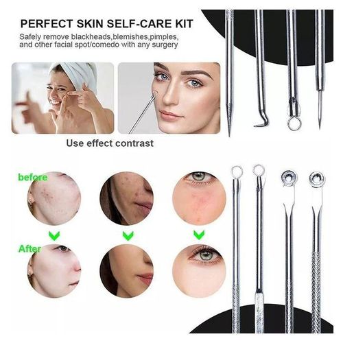 product_image_name-Generic-4pcs Stainless Steel Facial Acne  Remover Tool Set-2