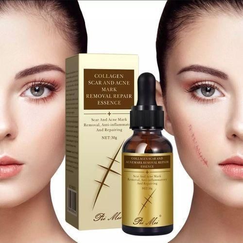 product_image_name-Pei Mei-TCM Scar & Acne Mark Removal  Repair Essence,  30g-2
