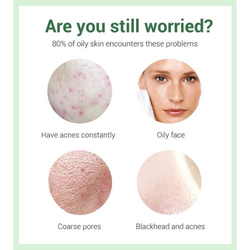 product_image_name-Breylee-Acne Treatment, Cleanser, Serum + Cream - 100g*17mls*20g-2