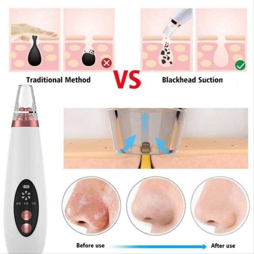 product_image_name-Face-Pore Acne Pimple Blackhead Remover Device Rechargeable-2