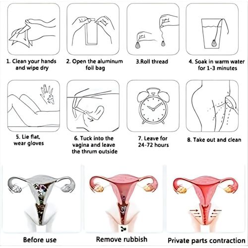 product_image_name-Generic-3-10 SACHETS ORIGINAL YONI DETOX PEARLS for Vagína Disorders, Yeast Infections and other vigínal discomforts -3