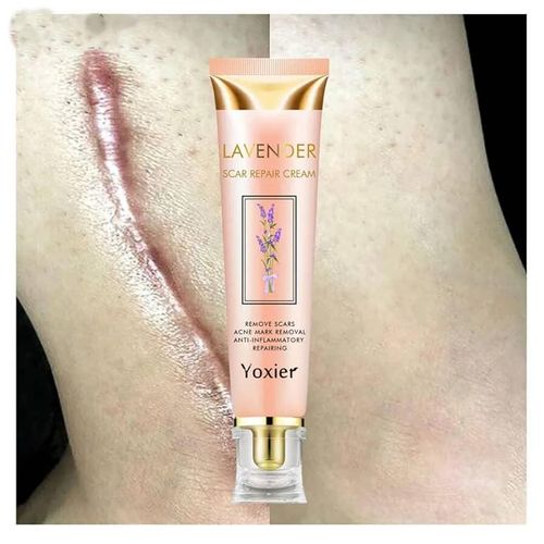 product_image_name-Quality- Yoxier Lavender Scar Repair Cream – Remove Scars, Acne Marks, Anti-Inflammatory – 20g-1