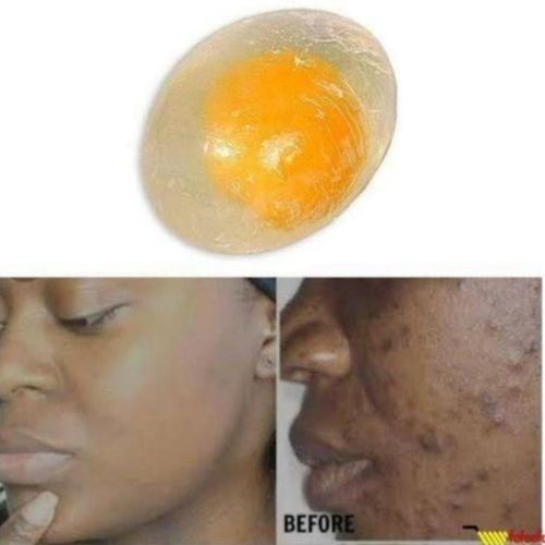product_image_name-Generic-Egg yolk  Collagen Facial Soap For Sun Burn, Acne, Dark Spots-1
