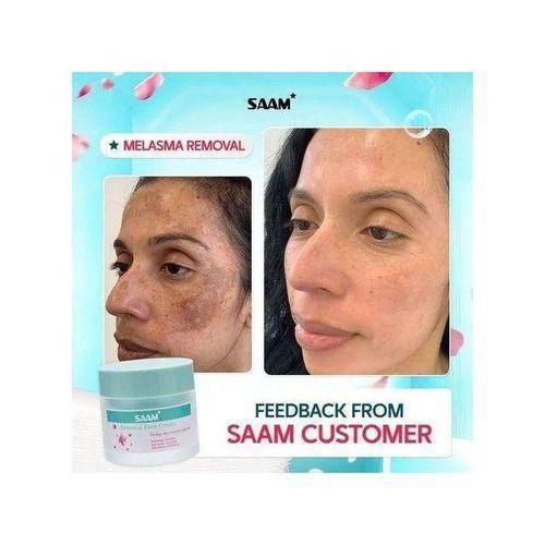 product_image_name-SAAM-New Renewal Face Cream Age Spots & Dark Spots Removal Face Cream-1
