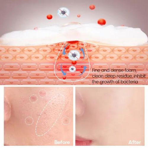 product_image_name-The Ordinary-Acne Control Cleanser - 100g-3