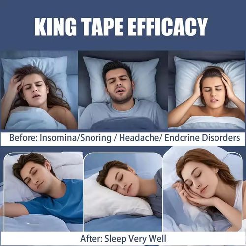 product_image_name-Generic-Breathable Mouth Tape Anti Snoring Sleep Strips Adhesive Tape Sleep Accessories for Improving Sleep - Black-3
