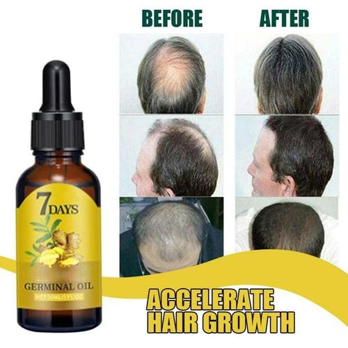 product_image_name-7 Day-Ginger Hair Growth Oil  - 40ml-2