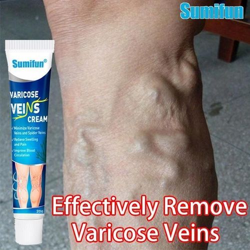product_image_name-Sumifun-varicose vein remover effective original - 20g-1