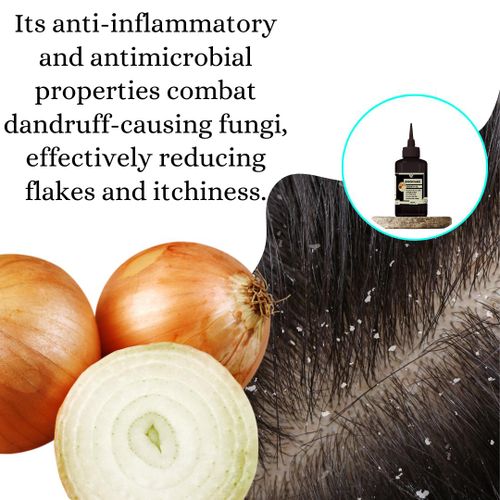 product_image_name-Mekis-Onion Hair Growth Oil -100% Pure,Stimulates Hair Growth,Strengthens Hair,Nourishes Scalp,Prevents Hair Fall-4