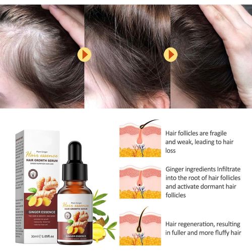 product_image_name-Ginger-Hair Growth Oil - 30mls-1