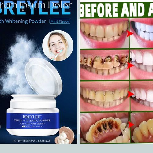 product_image_name-Teeth Whitening-Powder - 30g-1