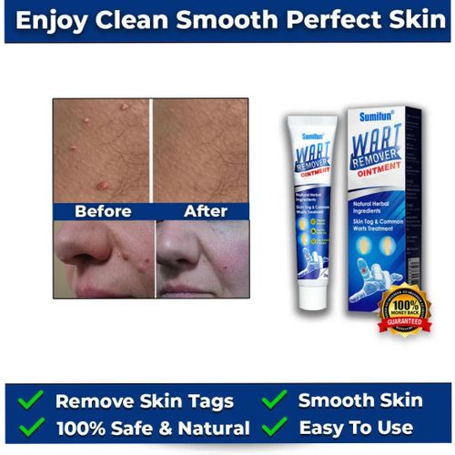 product_image_name-Sumifun-Wart Skin Tag Mole Treatment Gel - 20g-1