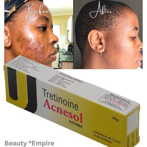 product_image_name-tretinoin-Acnesol Acne Cream 25g - Powerful Acne Treatment for Clearer, Smoother Skin-1