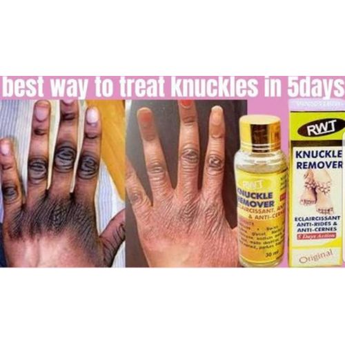 product_image_name-Rwt-Knuckles Remover Dark Knuckles ,dark spot knuckle remover serum-2