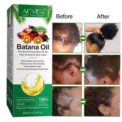 product_image_name-Aliver-Batana Hair Growth Oil - 60mls-1