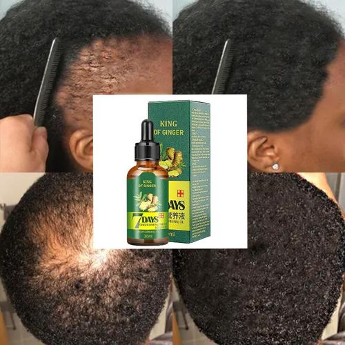 product_image_name-7 Day-7 Days Hair Growth Oil  - 30ml-1