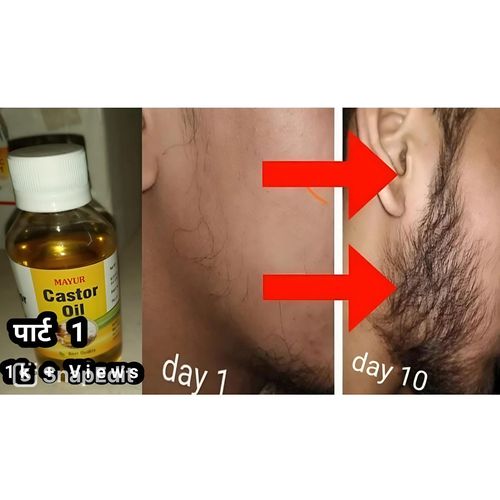 product_image_name-Castor Oil-Top class for hair and skin-1