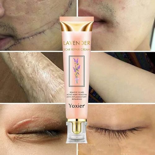 product_image_name-Skin Solution- Yoxier Lavender Scar Repair Cream – Remove Scars, Acne Marks, Anti-Inflammatory – 20g-1
