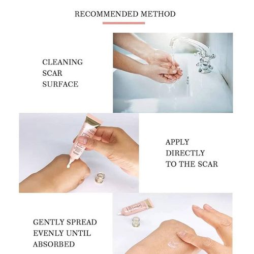 product_image_name-Skin Solution- Yoxier Lavender Scar Repair Cream – Remove Scars, Acne Marks, Anti-Inflammatory – 20g-2