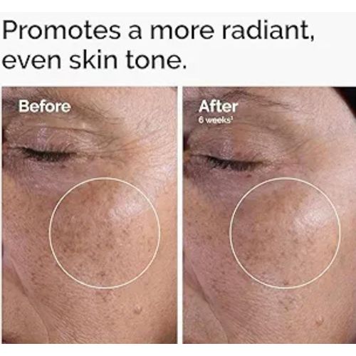 product_image_name-The Ordinary-Glycolic Acid 7% Exfoliating Toner. -5